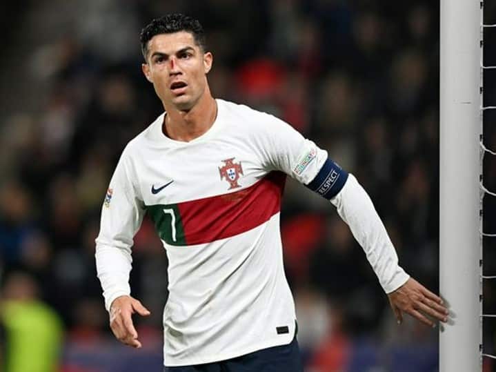 Cristiano Ronaldo suffered bloody injury in Portugal’s win over Czech Republic, My Football Facts
